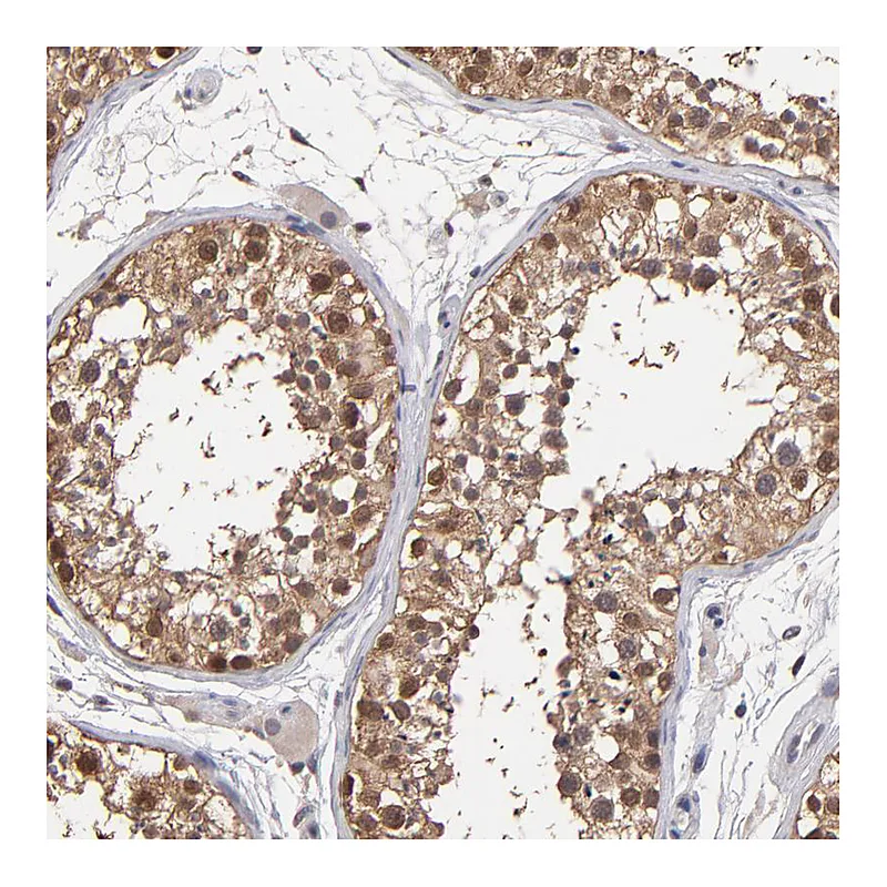 Atlas Antibodies Anti-PSMD10 Antibody