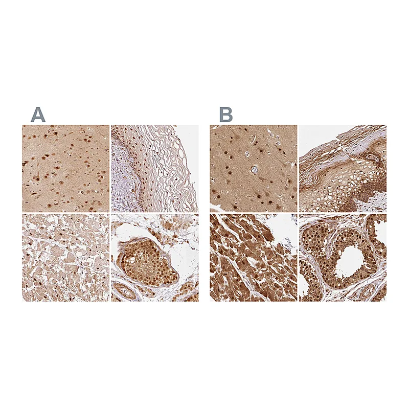 Atlas Antibodies Anti-PSMD1 Antibody