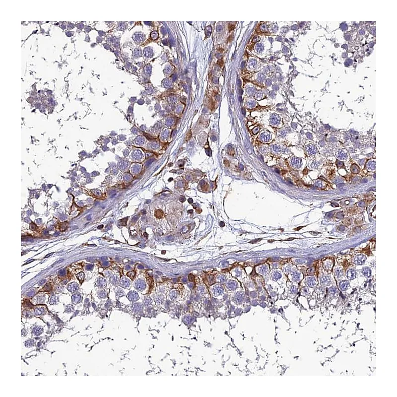 Atlas Antibodies Anti-PSMD11 Antibody