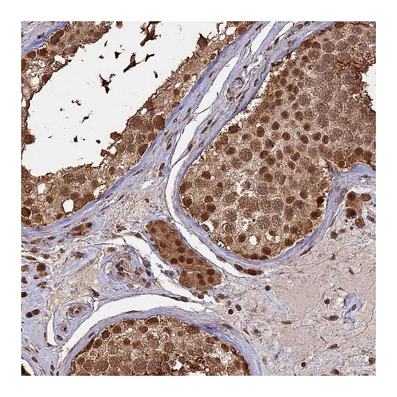 Atlas Antibodies Anti-PSMC6 Antibody
