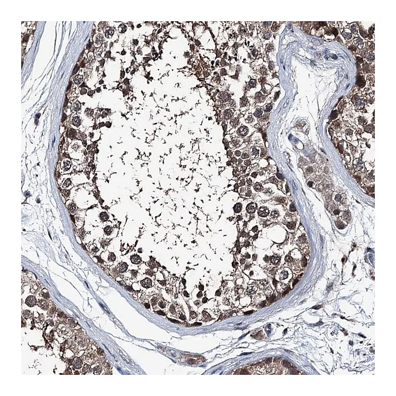 Atlas Antibodies Anti-PSMD13 Antibody