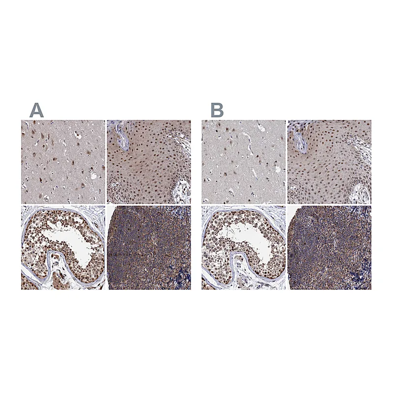 Atlas Antibodies Anti-PSMD4 Antibody