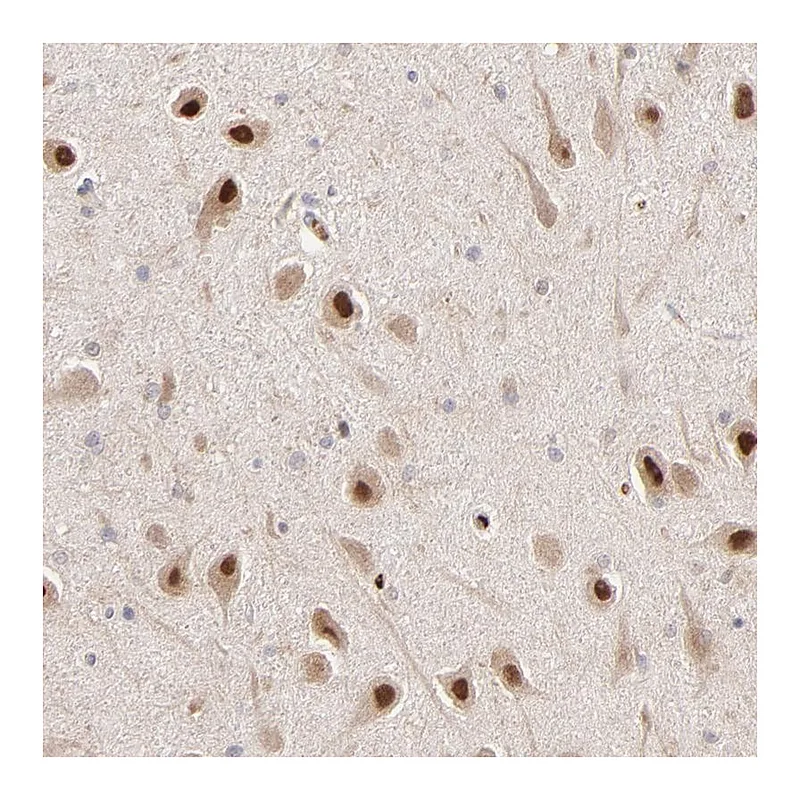 Atlas Antibodies Anti-PSMD14 Antibody