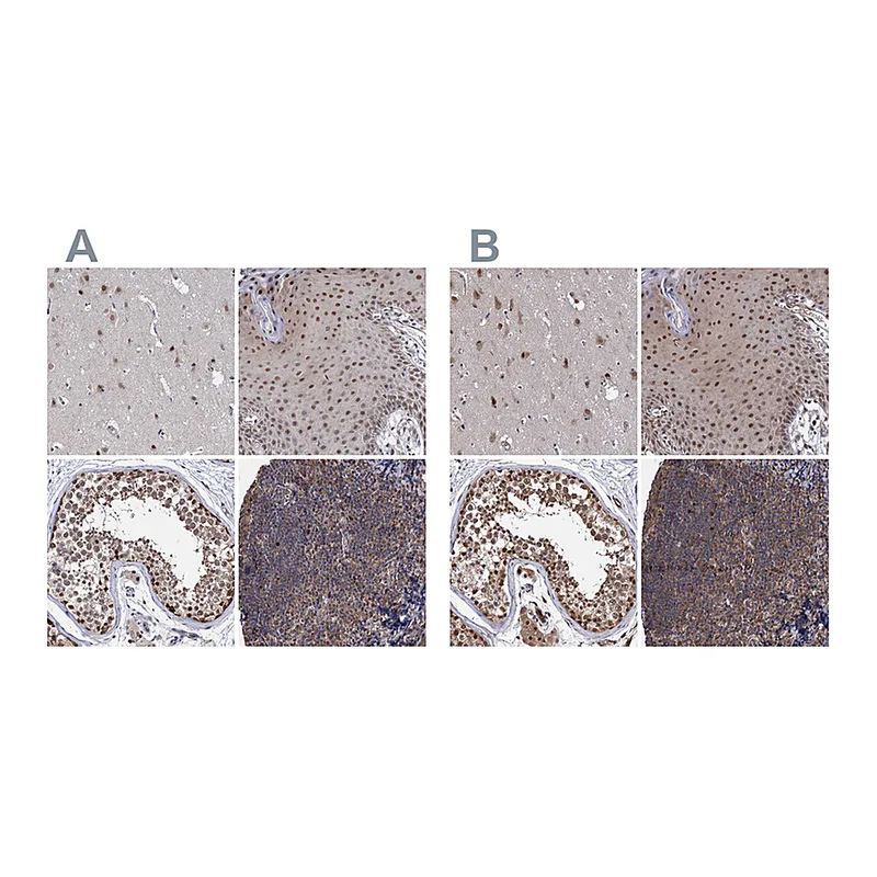 Atlas Antibodies Anti-PSMD4 Antibody