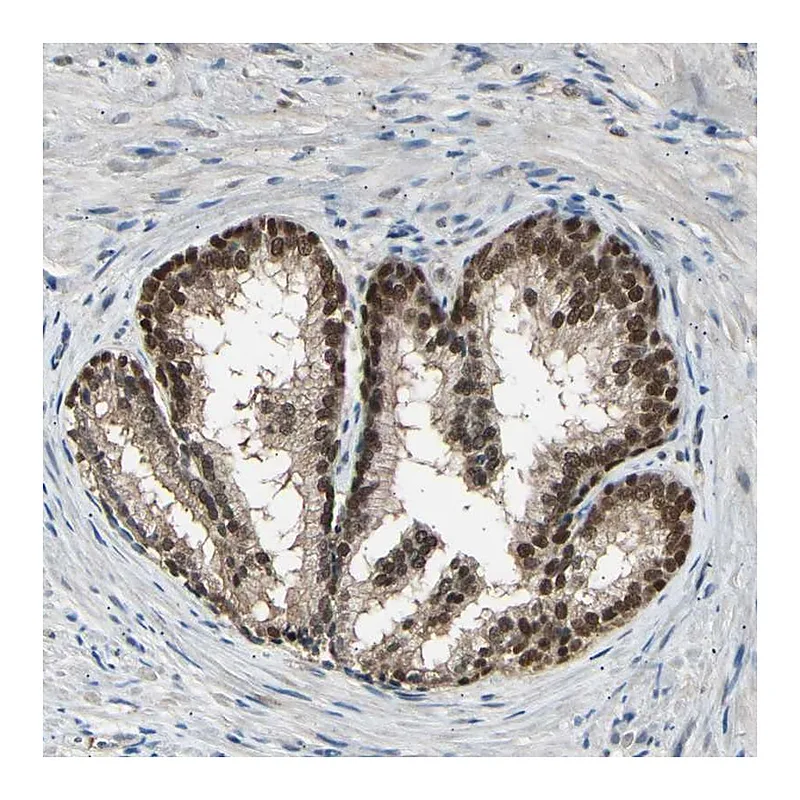 Atlas Antibodies Anti-PSMD5 Antibody