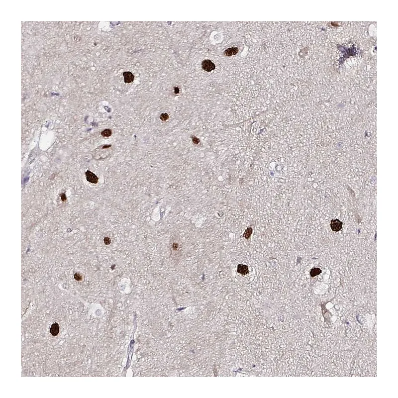 Atlas Antibodies Anti-PSMD3 Antibody