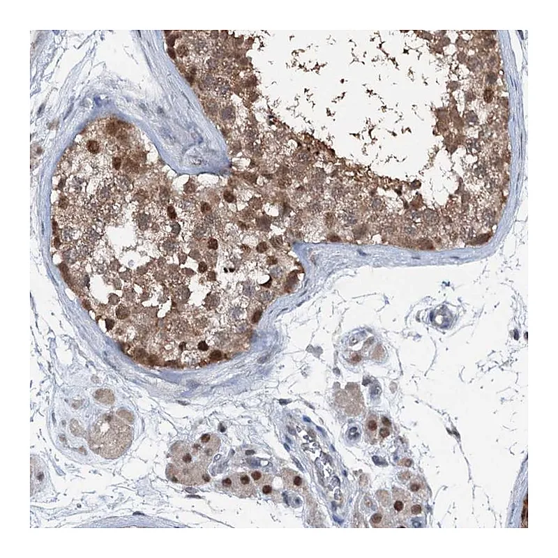 Atlas Antibodies Anti-PSMD13 Antibody