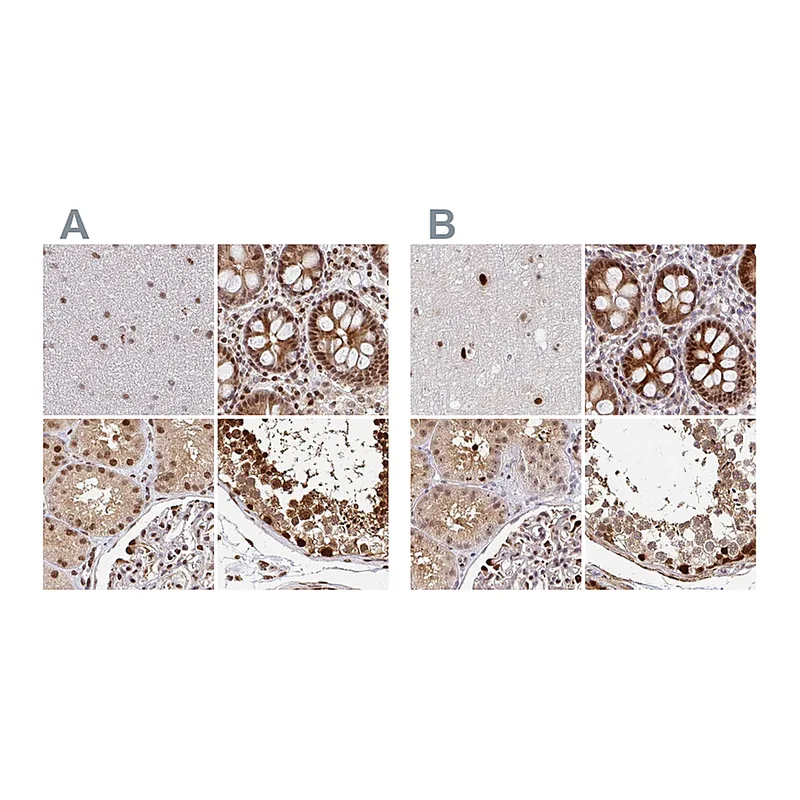 Atlas Antibodies Anti-PSMD7 Antibody