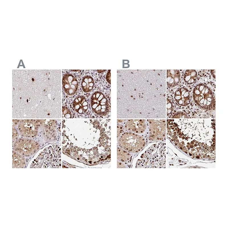 Atlas Antibodies Anti-PSMD7 Antibody