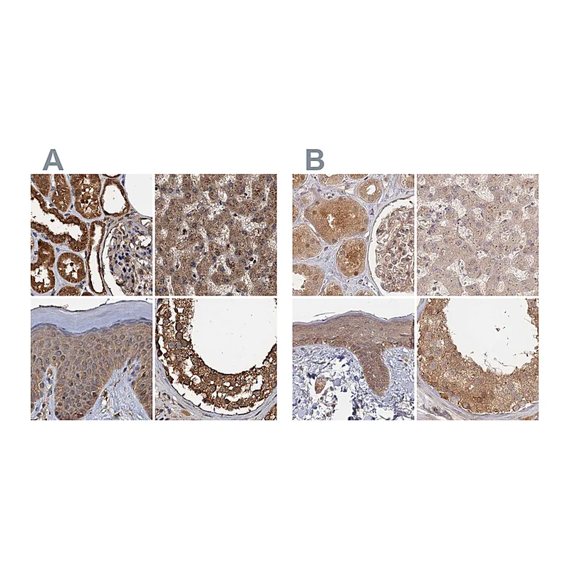 Atlas Antibodies Anti-PSMD9 Antibody