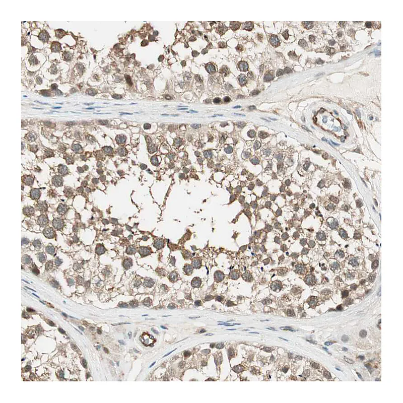 Atlas Antibodies Anti-PSMD8 Antibody