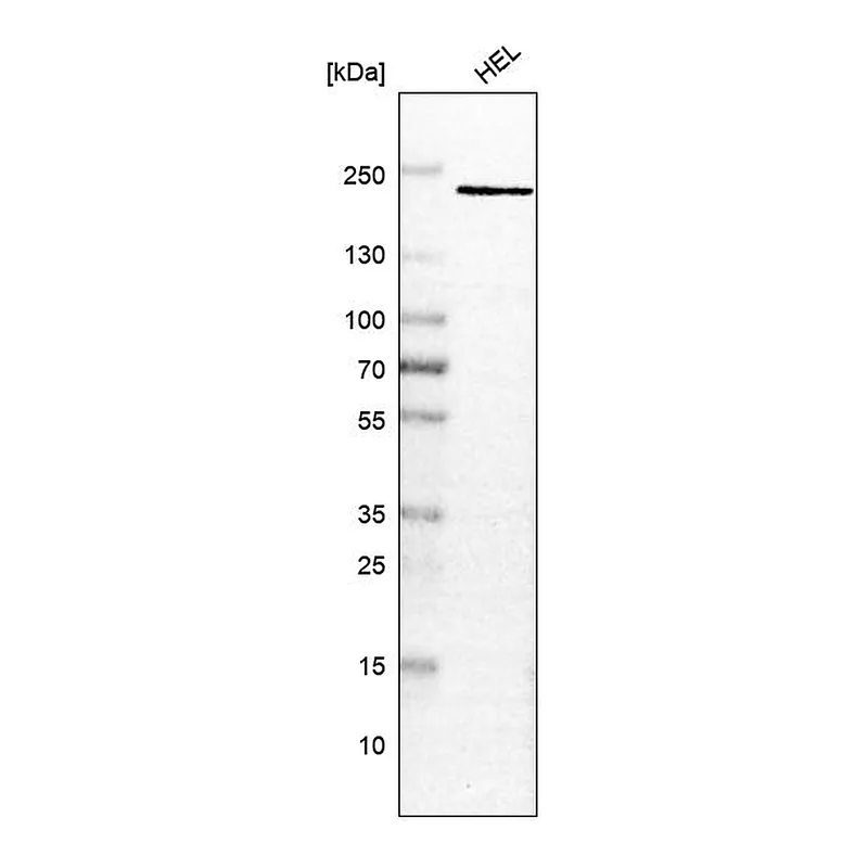 Atlas Antibodies Anti-PSME4 Antibody