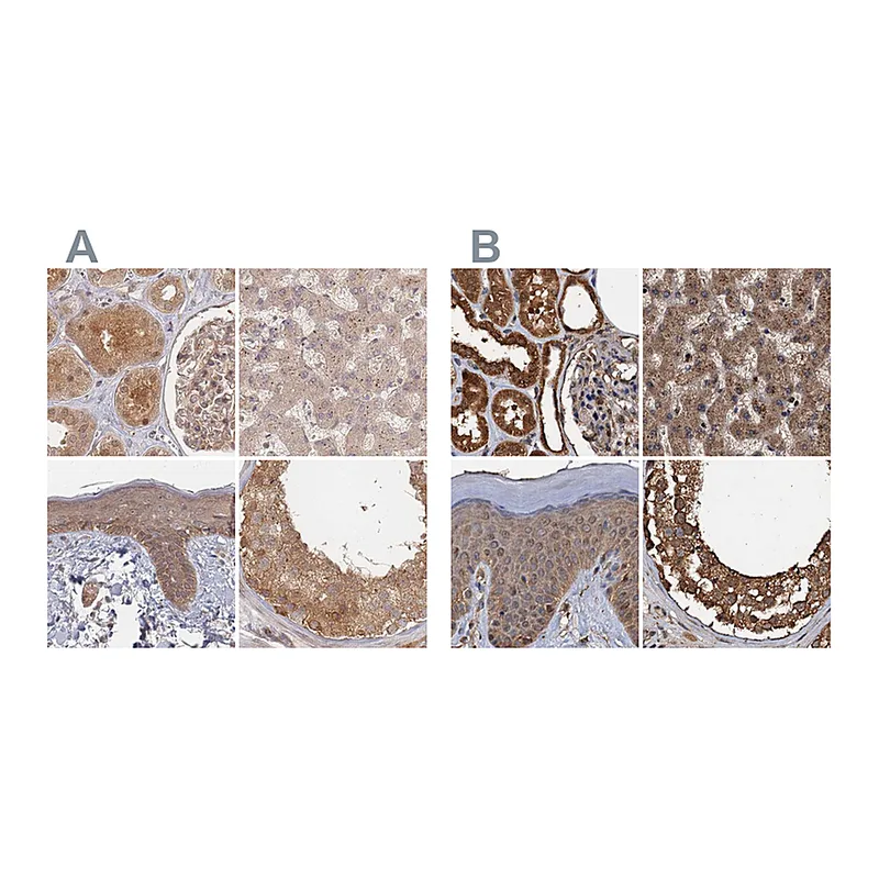 Atlas Antibodies Anti-PSMD9 Antibody