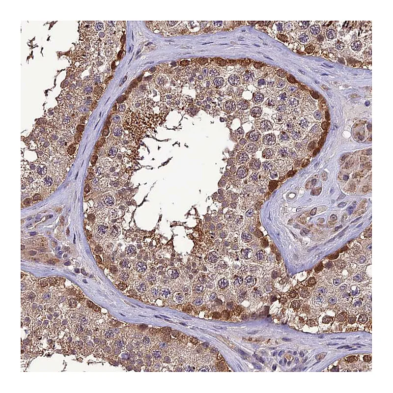 Atlas Antibodies Anti-PSMF1 Antibody