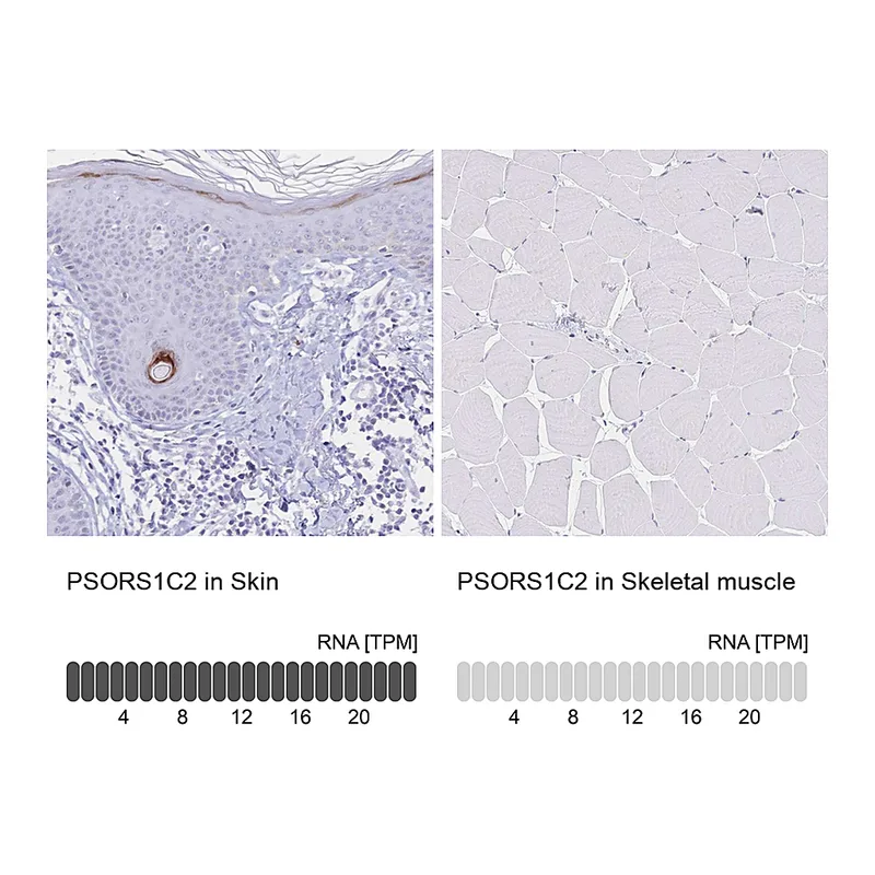 Atlas Antibodies Anti-PSORS1C2 Antibody