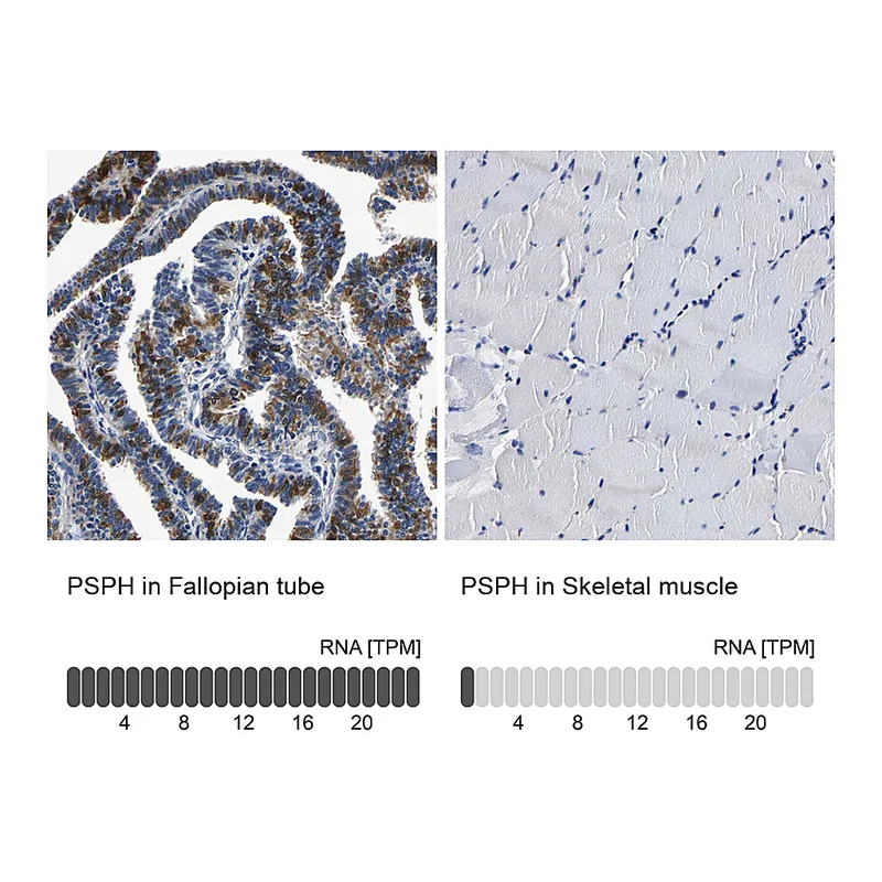 Atlas Antibodies Anti-PSPH Antibody