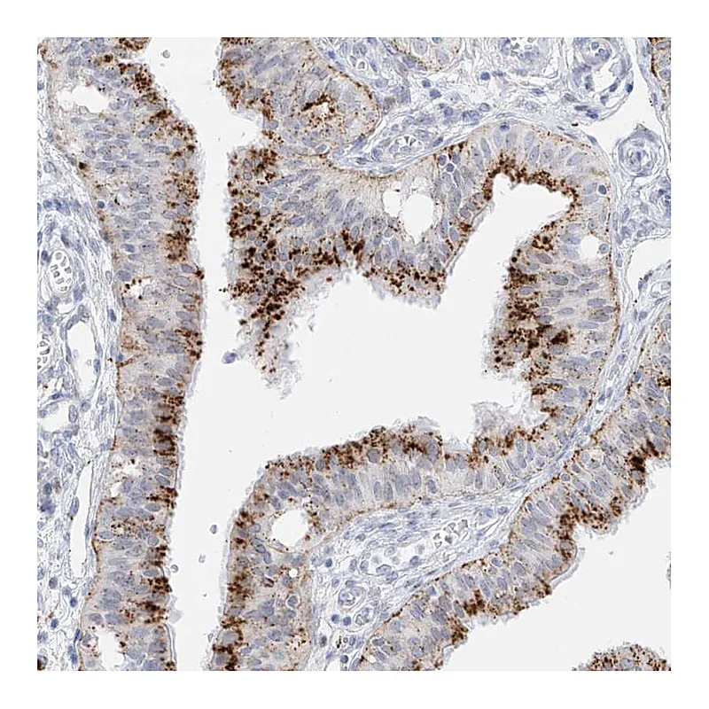 Atlas Antibodies Anti-PSPH Antibody