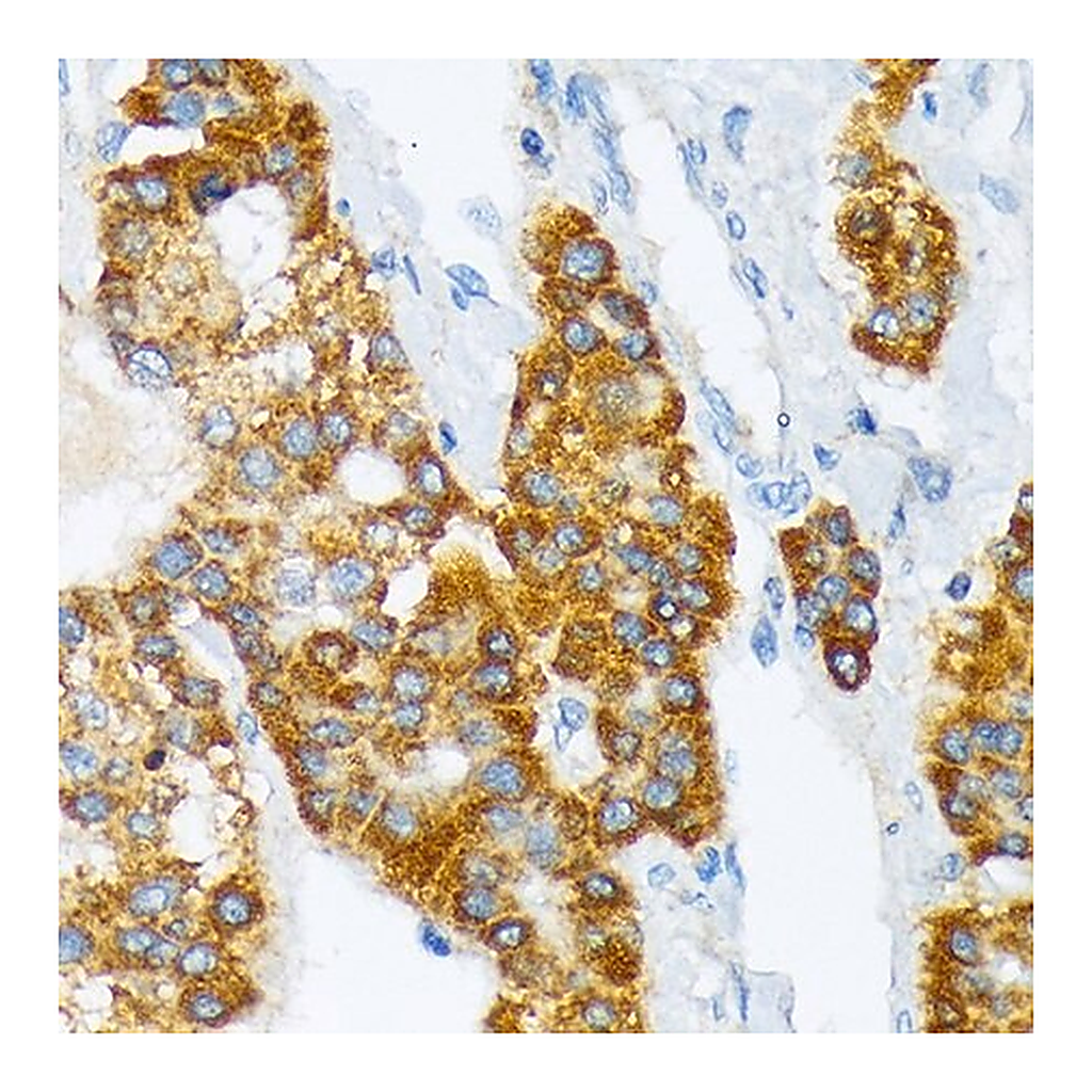 Merck Anti-ATP1B3 antibody produced in rabbit