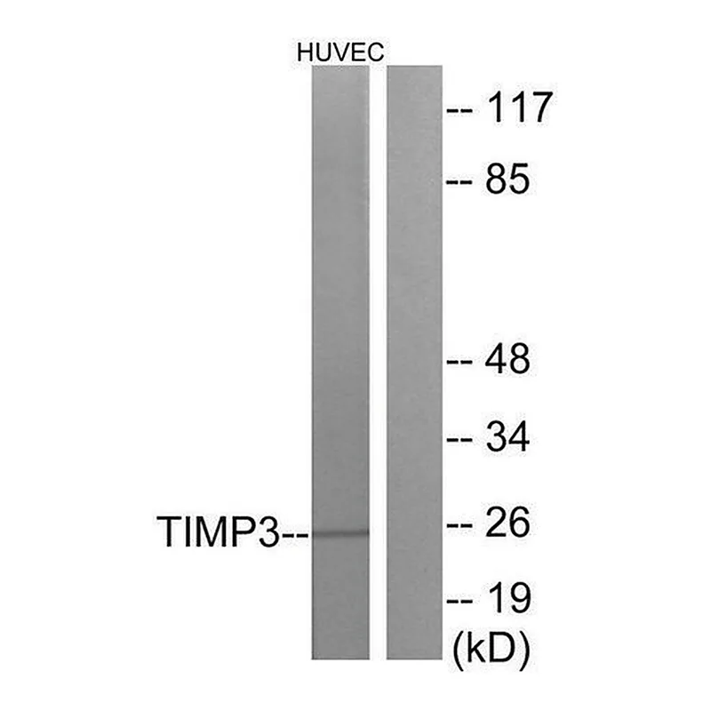 Merck Anti-TIMP3 antibody produced in rabbit