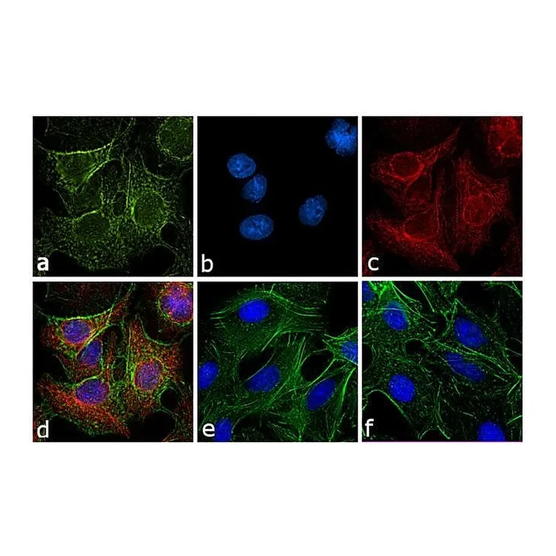 Thermo Fisher Scientific Goat anti-Rat IgG (H+L) Cross-Adsorbed Secondary Antibody, TRITC