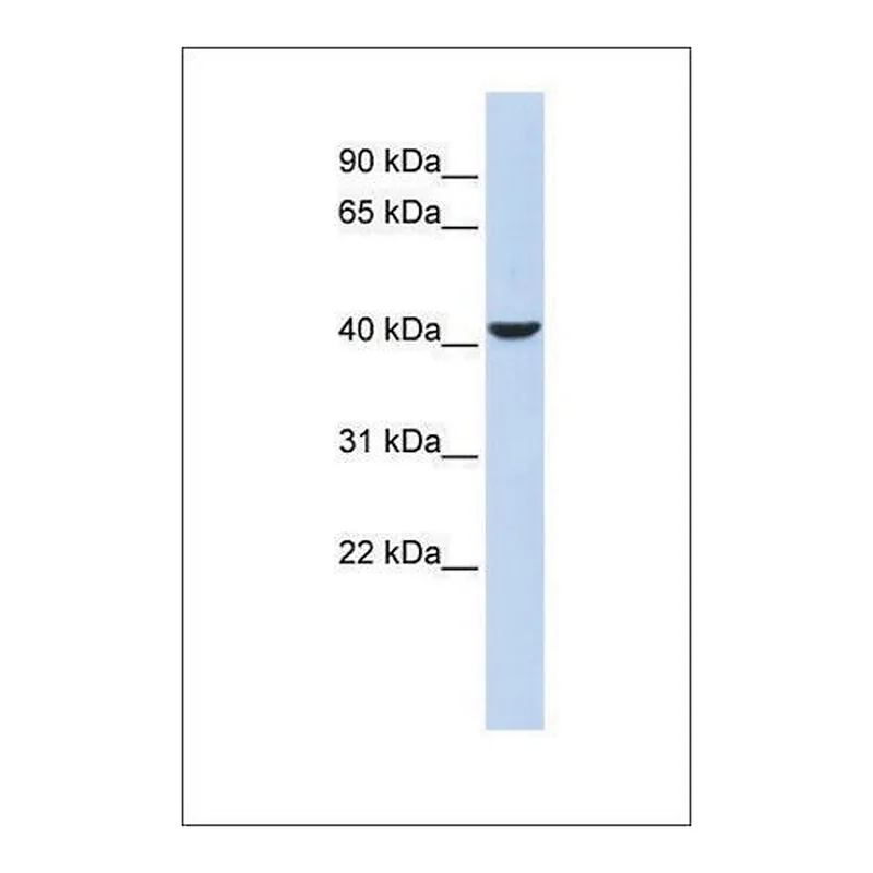 Merck Anti-MEF2B antibody produced in rabbit