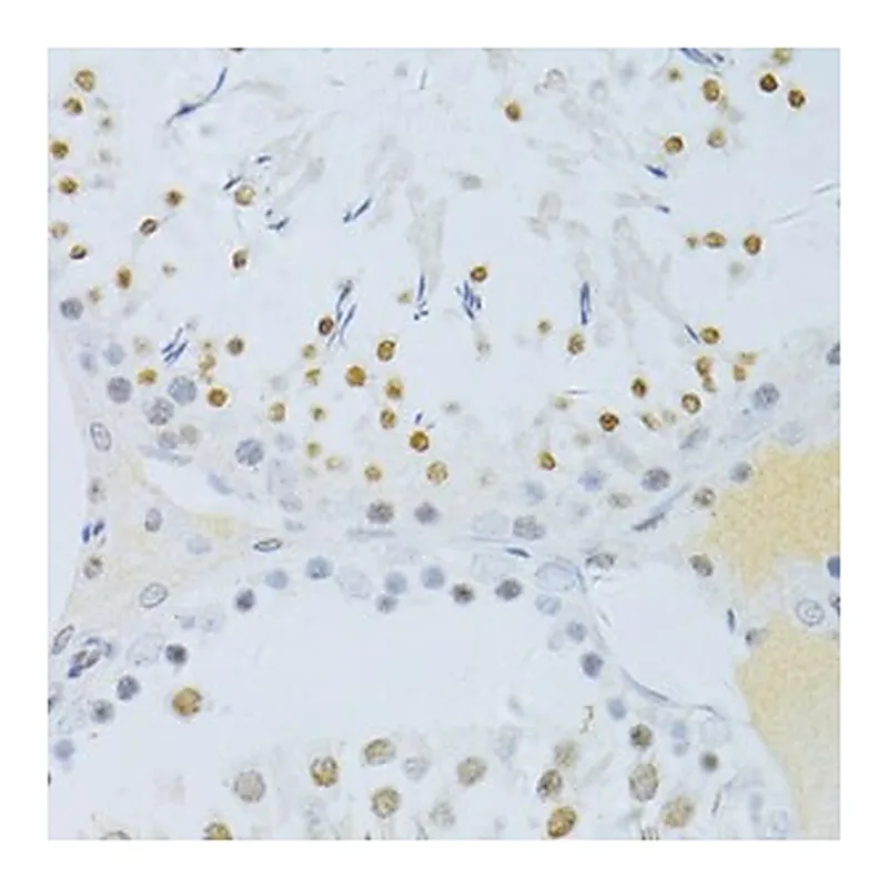 Merck ANTI-PHOSPHO-NF-KB P65-S276 ANTIBODY PR&