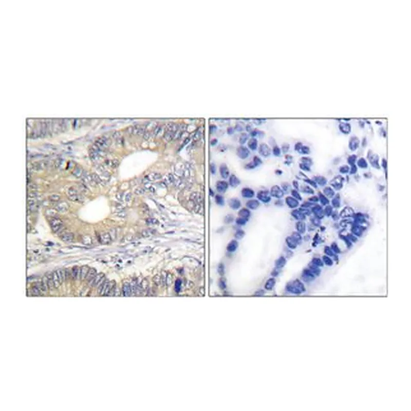 Merck ANTI-SOMATOSTATIN ANTIBODY PRODUCED IN R