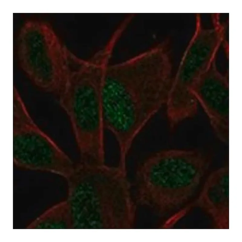 Merck Anti-ASCL1 antibody produced in rabbit