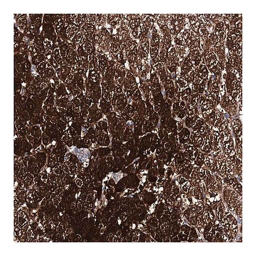 Merck Anti-AMDHD1 antibody produced in rabbit