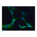 Merck ANTI-MYOSIN IIA, NON MUSCLE, DEVELOPED I