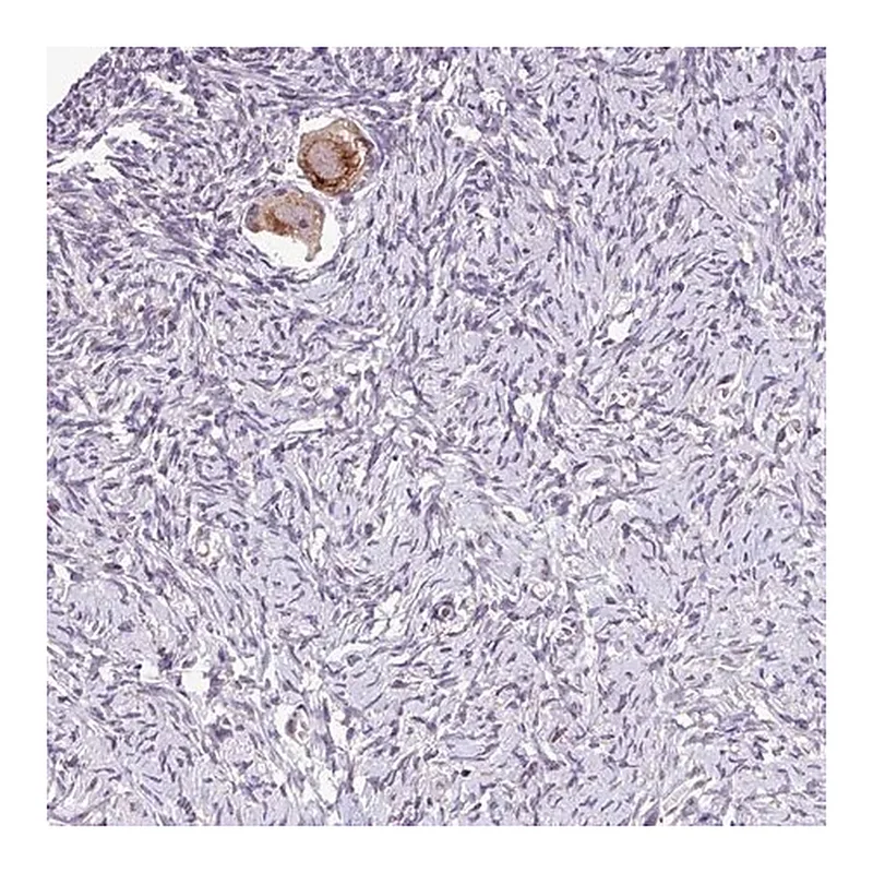 Merck Anti-TTLL3 antibody produced in rabbit