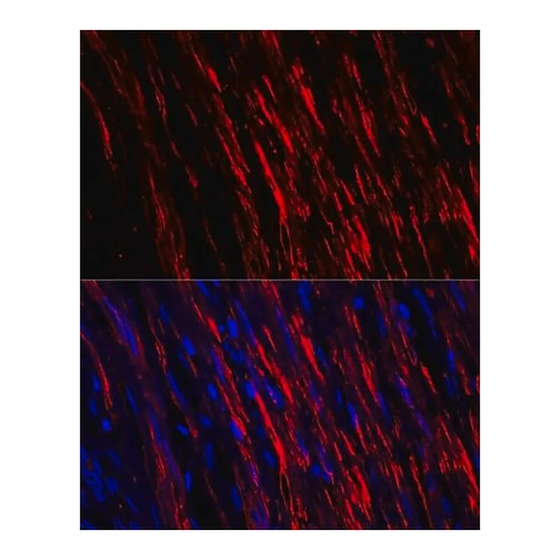 Merck Anti-alpha smooth muscle actin antibody produced in rabbit