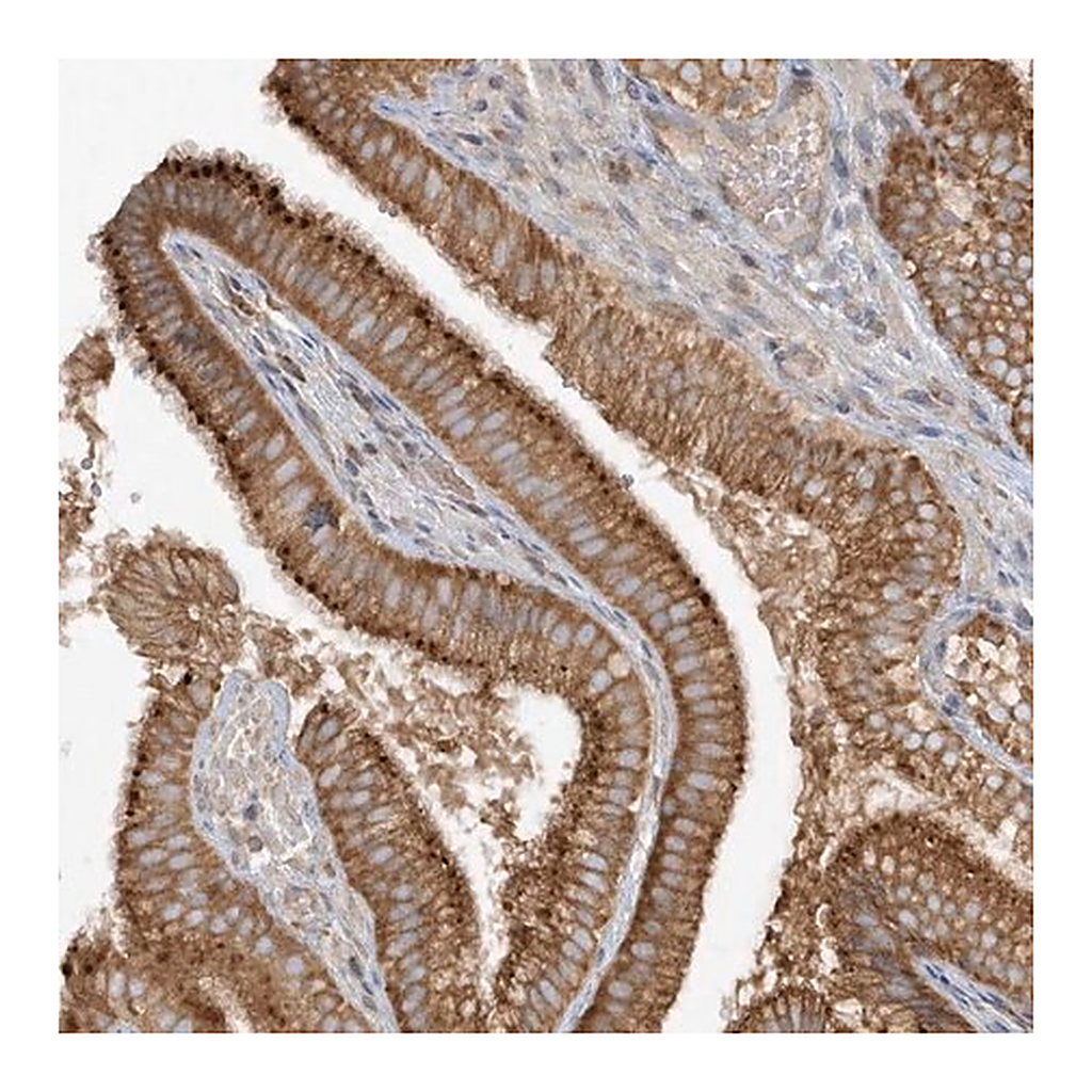Merck Anti-CNOT10 antibody produced in rabbit