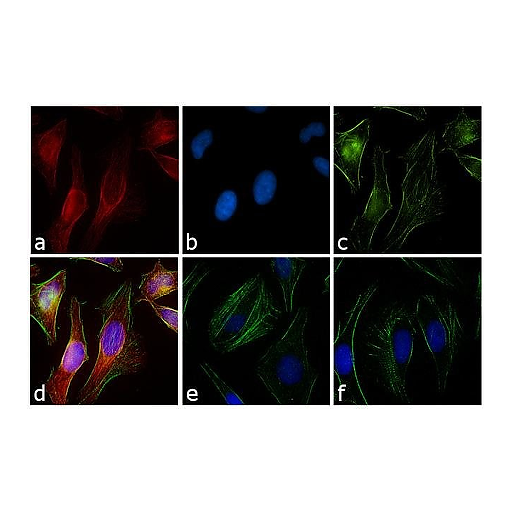 Thermo Fisher Scientific Goat anti-Rabbit IgG (H+L) Cross-Adsorbed Secondary Antibody, Rhodamine