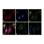 Thermo Fisher Scientific Goat anti-Rabbit IgG (H+L) Cross-Adsorbed Secondary Antibody, Rhodamine