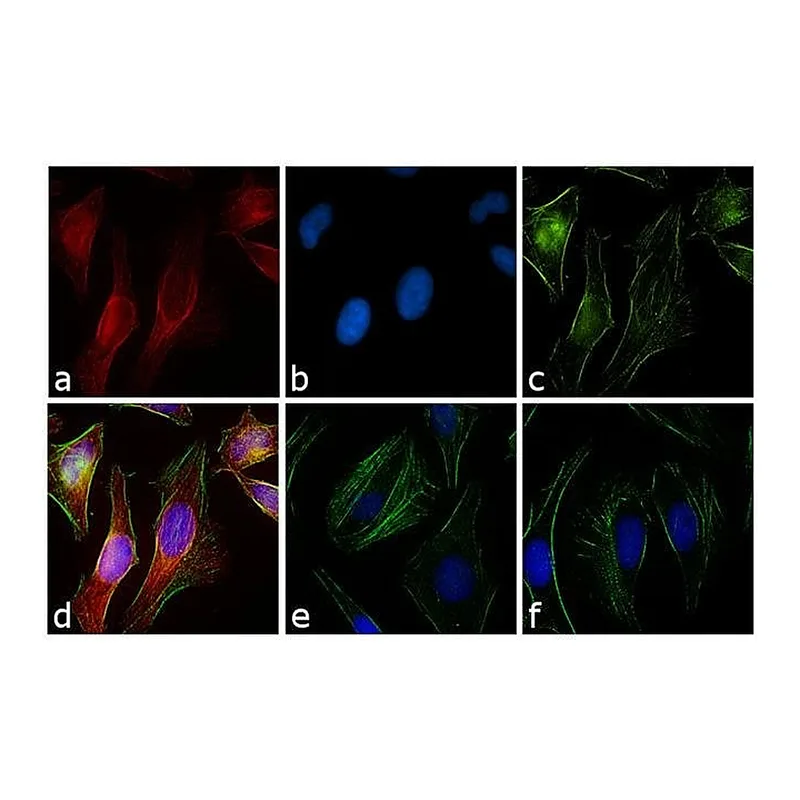 Thermo Fisher Scientific Goat anti-Rabbit IgG (H+L) Cross-Adsorbed Secondary Antibody, Rhodamine