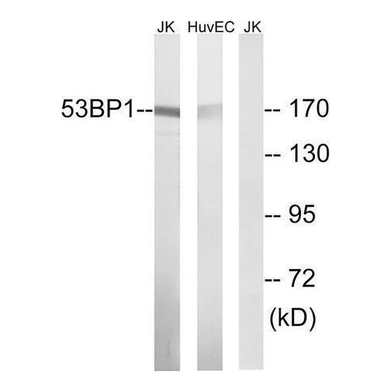 Merck Anti-53BP1 antibody produced in rabbit