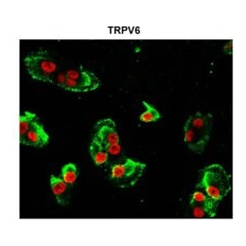 Merck Anti-TRPV6