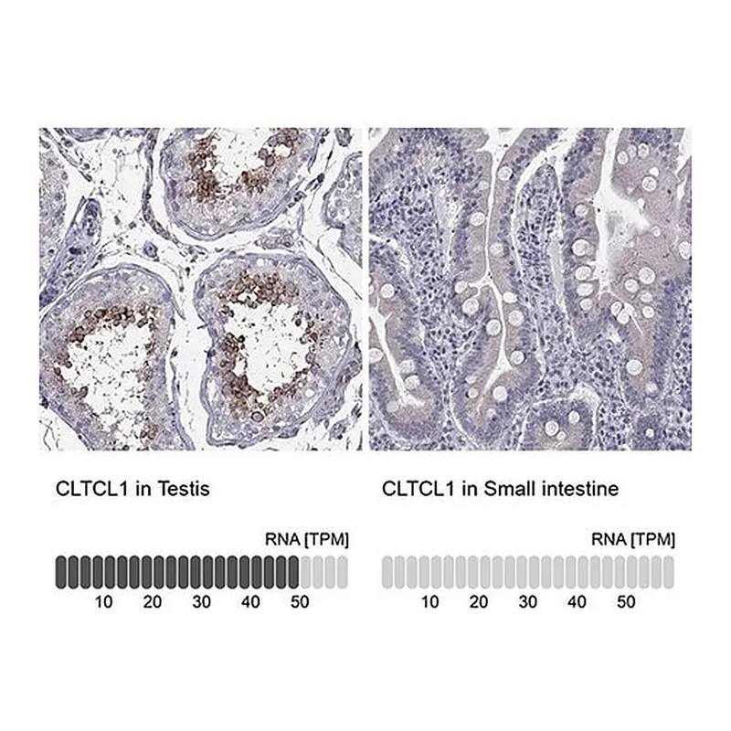 Merck Anti-CLTCL1 antibody produced in rabbit