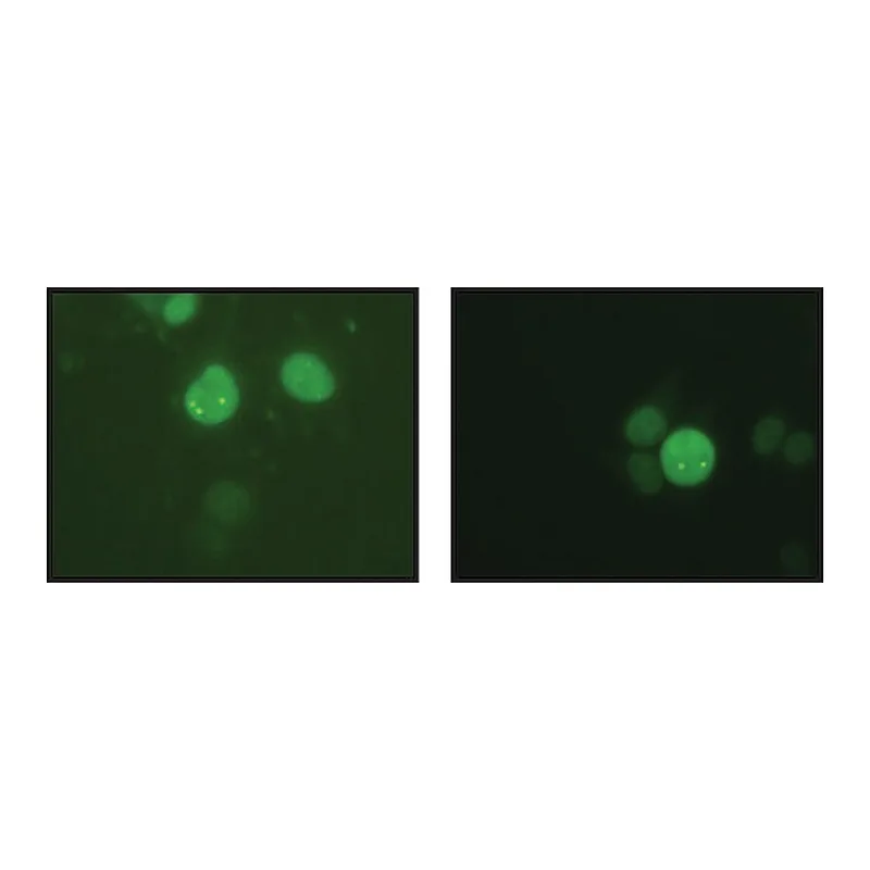 Merck Anti-NBS1 (Nibrin) antibody produced in rabbit