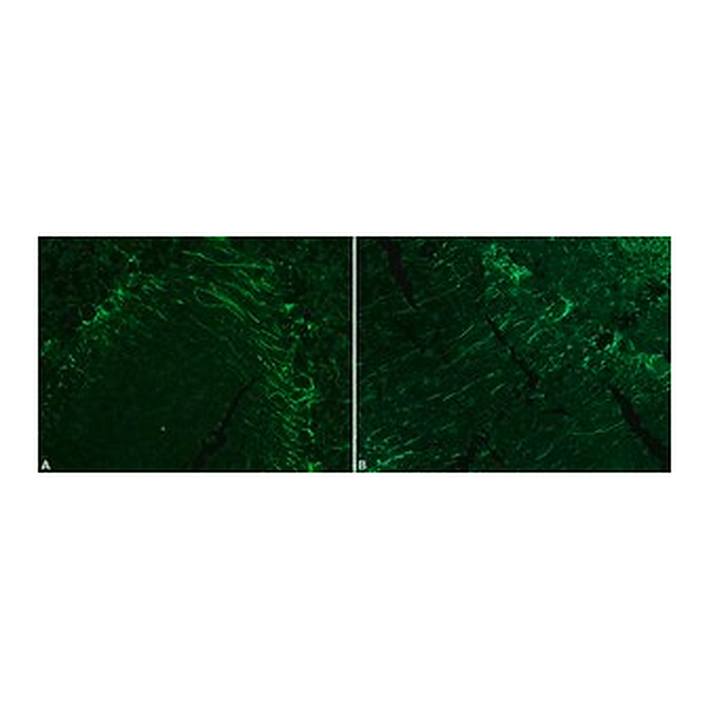 Merck MOUSE MONOCLONAL ANTI-NEUROFILAMENT 200&