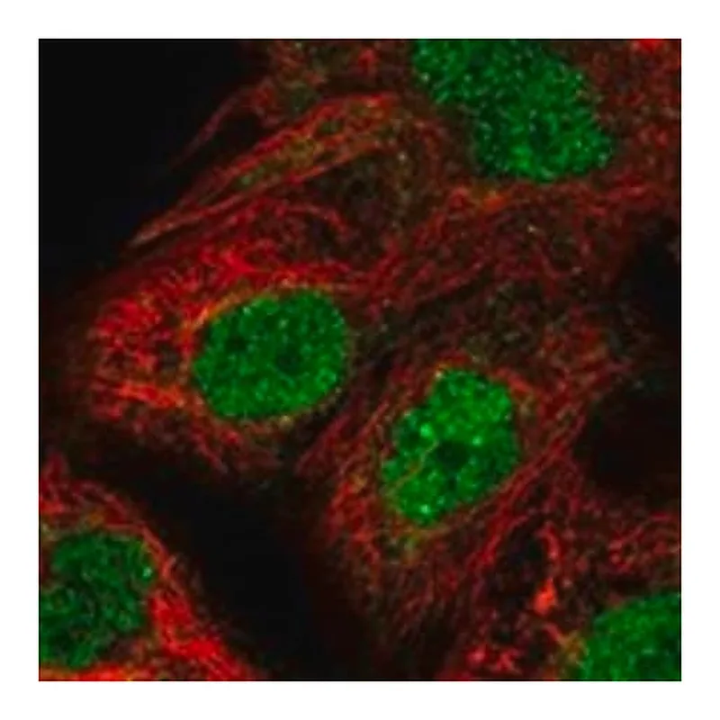 Merck Anti-PSMB4 antibody produced in rabbit