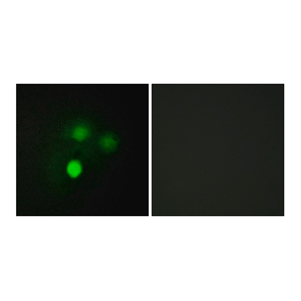 Merck Anti-KNTC2 antibody produced in rabbit