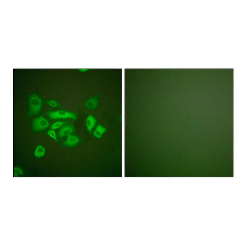 Merck Anti-Keratin 10 antibody produced in rabbit
