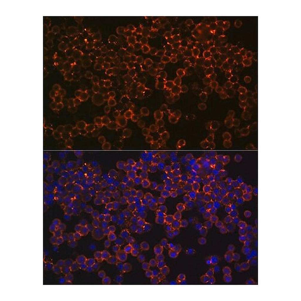 Merck Anti-IFNGR1 antibody produced in rabbit