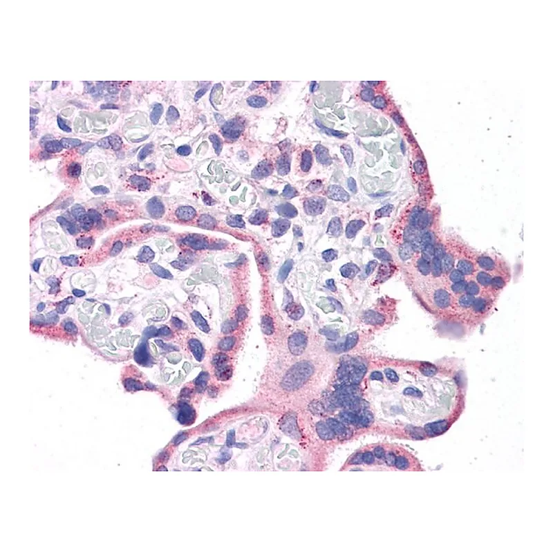 Merck Anti-WT1