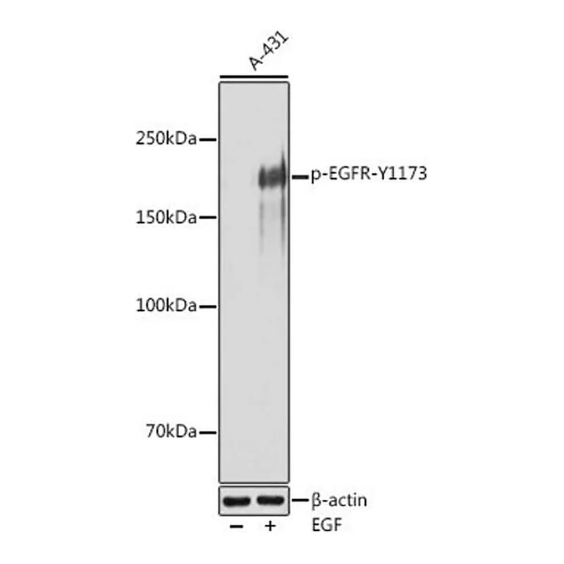 Merck Anti-Phospho-EGFR-Y1173 antibody produced in rabbit