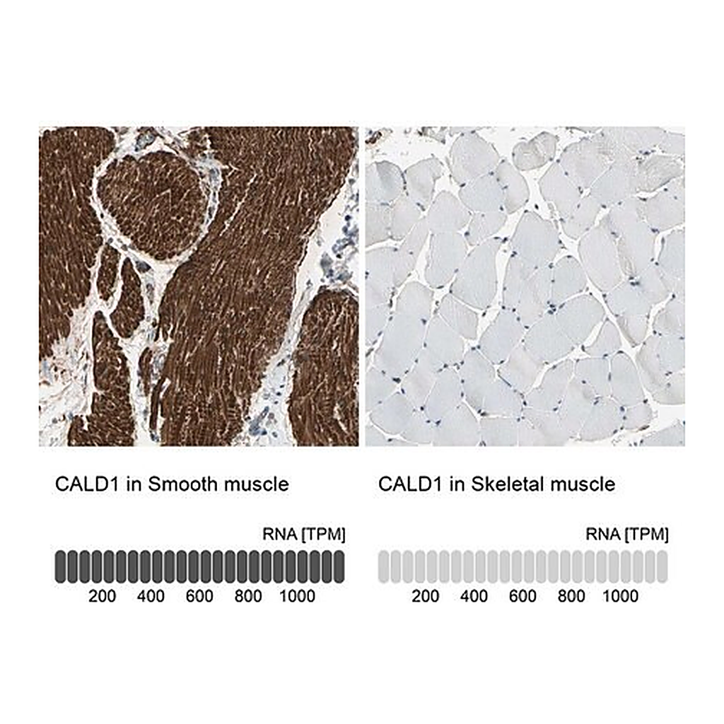 Merck Anti-CALD1 antibody produced in rabbit