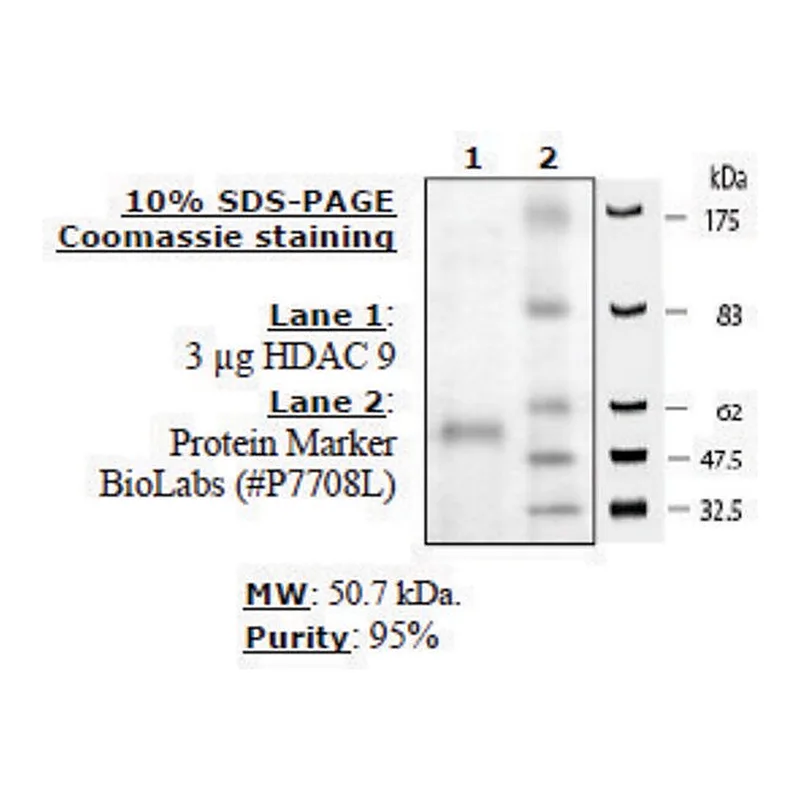 Merck HDAC-9 human