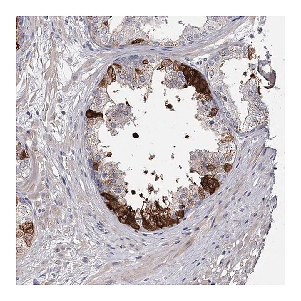 Merck Anti-FDXACB1 antibody produced in rabbit